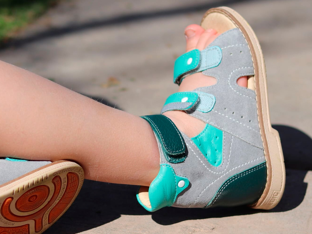 Hueso Sumergido Palabra Zapatos ortopédicos para bebés y niños - LuckyBear Blog