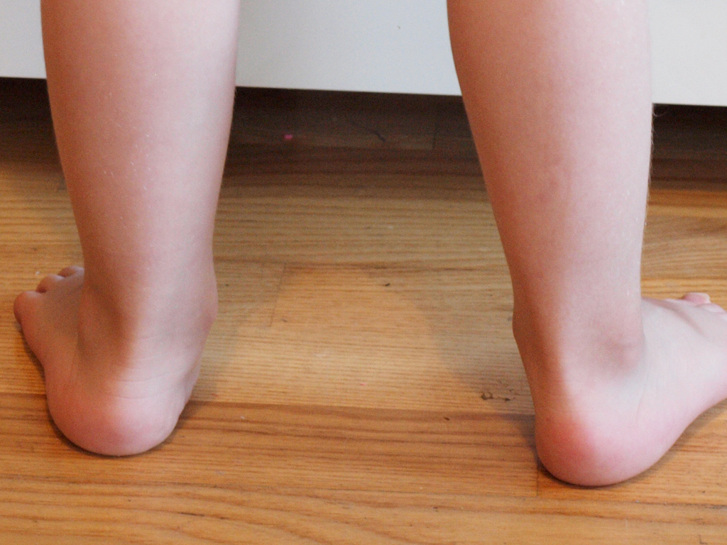 Zapatos ortopédicos bebés y niños - LuckyBear Blog